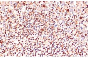 Immunohistochemistry of paraffin-embedded Human tonsil using ALOX5 Polyclonal Antibody at dilution of 1:100 (40x lens). (ALOX5 抗体)