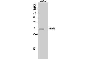 Western Blotting (WB) image for anti-Natural Cytotoxicity Triggering Receptor 1 (NCR1) antibody (ABIN5958615) (NCR1 抗体)