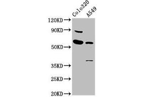 Western Blot Positive WB detected in: Colo320 whole cell lysate, A549 whole cell lysate All lanes: EBF3 antibody at 5. (EBF3 抗体  (AA 416-530))