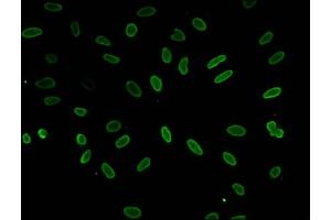 Immunofluorescent analysis of Hela cells (sodium butyrate, 30 mM, 4h) using ABIN7139188 at dilution of 1:100 and Alexa Fluor 488-congugated AffiniPure Goat Anti-Rabbit IgG(H+L) (HIST1H1E 抗体  (acLys51))