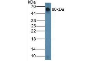 Detection of CHRD in Mouse Lung Tissue using Polyclonal Antibody to Chordin (CHRD) (Chordin 抗体  (AA 422-635))