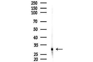anti-Cytochrome B5 Reductase 2 (CYB5R2) (Internal Region) antibody