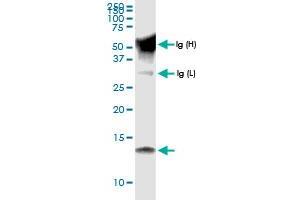 Immunoprecipitation of CCL15 transfected lysate using anti-CCL15 MaxPab rabbit polyclonal antibody and Protein A Magnetic Bead , and immunoblotted with CCL15 MaxPab rabbit polyclonal antibody (D01) . (CCL15 抗体  (AA 1-113))