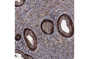 Immunohistochemical staining of human prostate with TXNDC11 polyclonal antibody  shows distinct cytoplasmic positivity in glandular cells. (TXNDC11 抗体)