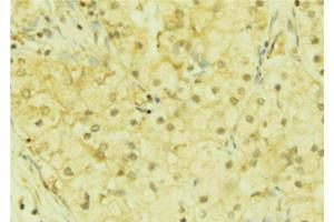 ABIN6272852 at 1/100 staining Mouse liver tissue by IHC-P.