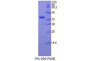SDS-PAGE (SDS) image for Telomerase Reverse Transcriptase (TERT) (AA 673-976) protein (His tag) (ABIN1878403)