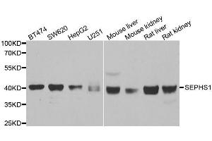 Western blot analysis of extracts of various cell lines, using SEPHS1 antibody. (SEPHS1 抗体  (AA 1-392))