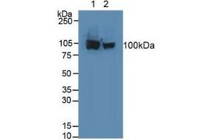 Western blot analysis of (1) Human HeLa cells and (2) Human HepG2 Cells. (Aconitase 1 抗体  (AA 26-243))