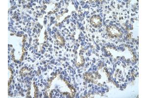 Rabbit Anti-TRA2B Antibody       Paraffin Embedded Tissue:  Human alveolar cell   Cellular Data:  Epithelial cells of renal tubule  Antibody Concentration:   4. (TRA2B 抗体  (Middle Region))