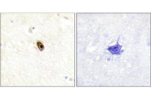 Immunohistochemistry analysis of paraffin-embedded human brain tissue using AurB/C (Phospho-Thr236/202) antibody. (Aurora Kinase C 抗体  (pThr202, pThr236))