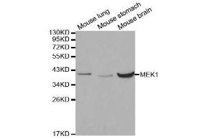 Western blot analysis of extracts of various cell lines, using MAP2K1 antibody. (MEK1 抗体  (AA 1-100))