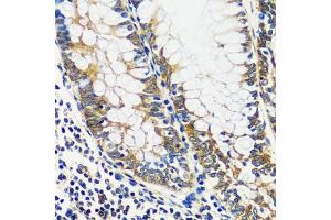 Immunohistochemistry of paraffin-embedded human colon using CCDC124 antibody  at dilution of 1:100 (40x lens). (CCDC124 抗体  (AA 1-223))