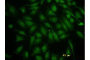 Image no. 1 for anti-Phosphoinositide 3-kinase Regulatory Subunit 4 (PIK3R4) (AA 1259-1359) antibody (ABIN599234) (PIK3R4 抗体  (AA 1259-1359))