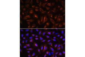Immunofluorescence analysis of U-2 OS cells using B antibody (ABIN6130859, ABIN6137109, ABIN6137110 and ABIN6220869) at dilution of 1:100. (ARL13B 抗体  (AA 1-240))