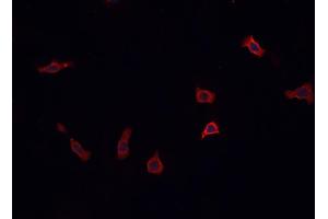 ABIN6269379 staining PC12  cells by IF/ICC. (STX1A 抗体  (N-Term))