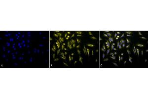 Immunocytochemistry/Immunofluorescence analysis using Rabbit Anti-KDEL Polyclonal Antibody (ABIN863187 and ABIN863188). (KDEL 抗体)