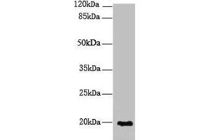 Western blot All lanes: NUDT11 antibody at 2 μg/mL + U251 whole cell lysate Secondary Goat polyclonal to rabbit IgG at 1/10000 dilution Predicted band size: 19 kDa Observed band size: 19 kDa (NUDT11 抗体  (AA 1-164))