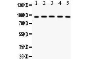 Anti- NR3C1 antibody, Western blotting All lanes: Anti NR3C1  at 0. (Glucocorticoid Receptor 抗体  (AA 1-373))
