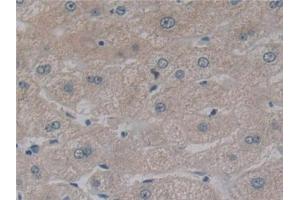 Detection of NFkB in Human Liver Tissue using Polyclonal Antibody to Nuclear Factor Kappa B (NFkB) (NFkB 抗体  (AA 805-892))