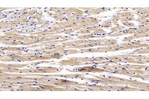 Detection of CTGF in Rabbit Cardiac Muscle Tissue using Polyclonal Antibody to Connective Tissue Growth Factor (CTGF) (CTGF 抗体  (AA 118-388))