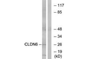 Western blot analysis of extracts from Jurkat cells, using CLDN6 Antibody. (Claudin 6 抗体  (AA 81-130))