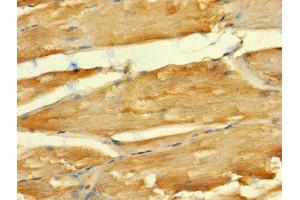 Immunohistochemistry of paraffin-embedded human skeletal muscle tissue using ABIN7143040 at dilution of 1:100 (ABLIM2 抗体  (AA 222-521))