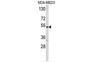 Western blot analysis of CYP2A13 Antibody (C-term) in MDA-MB231 cell line lysates (35ug/lane). (CYP2A13 抗体  (C-Term))
