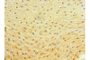 Immunohistochemistry of paraffin-embedded human esophagus tissue using ABIN7142595 at dilution of 1:100 (ALAS2 抗体  (AA 50-320))
