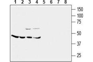 Western blot analysis of mouse brain membrane (lanes 1 and 5), rat cerebellum (lanes 2 and 6), rat lung (lanes 3 and 7) and rat kidney (lanes 4 and 8) lysates: - 1-4. (CRHR2 抗体  (Extracellular))