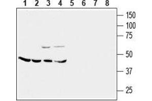 Western blot analysis of mouse brain membrane (lanes 1 and 5), rat cerebellum (lanes 2 and 6), rat lung (lanes 3 and 7) and rat kidney (lanes 4 and 8) lysates: - 1-4. (CRHR2 抗体  (Extracellular, N-Term))