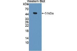 Detection of Recombinant CPA3, Mouse using Polyclonal Antibody to Carboxypeptidase A3 (CPA3) (CPA3 抗体  (AA 16-417))