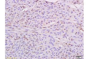 Immunohistochemistry (IHC) image for anti-Inhibitor of kappa Light Polypeptide Gene Enhancer in B-Cells, Kinase epsilon (IKBKE) (AA 501-600) antibody (ABIN754033)