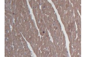 Detection of SHBG in Rat Cardiac Muscle Tissue using Monoclonal Antibody to Sex Hormone Binding Globulin (SHBG) (SHBG 抗体  (AA 222-358))