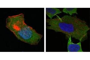 Confocal immunofluorescence analysis of HepG2 (left) and L-02 (right) cells using GSTP1 antibody (green). (GSTP1 抗体)