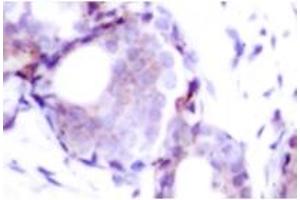 Image no. 1 for anti-Myc Proto-Oncogene protein (MYC) (pSer373) antibody (ABIN318072) (c-MYC 抗体  (pSer373))
