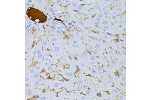 Immunohistochemistry of paraffin-embedded rat liver using TAPBP antibody (ABIN6293644) at dilution of 1:100 (40x lens).
