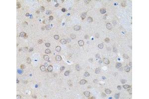 Immunohistochemistry of paraffin-embedded Rat brain using UBE2A Polyclonal Antibody (UBE2A 抗体)