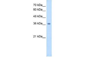 WNT16 antibody used at 2. (WNT16 抗体  (C-Term))
