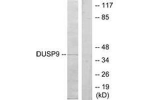 Western Blotting (WB) image for anti-Dual Specificity Phosphatase 9 (DUSP9) (AA 151-200) antibody (ABIN2879162) (DUSP9 抗体  (AA 151-200))