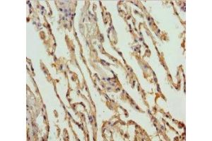Immunohistochemistry of paraffin-embedded human lung tissue using ABIN7149965 at dilution of 1:100 (FMO5 抗体  (AA 1-285))
