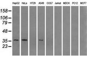 Western blot analysis of extracts (35 µg) from 9 different cell lines by using anti-AKR1A1 monoclonal antibody. (AKR1A1 抗体)