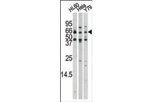 Image no. 2 for anti-RAD9 Homolog A (S. Pombe) (RAD9A) (pSer272) antibody (ABIN358200)