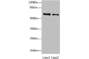 Western blot All lanes: ZNF626 antibody at 10 μg/mL Lane 1: HepG2 whole cell lysate Lane 2: Raji whole cell lysate Secondary Goat polyclonal to rabbit IgG at 1/10000 dilution Predicted band size: 61, 53, 11 kDa Observed band size: 61 kDa (ZNF626 抗体  (AA 1-92))