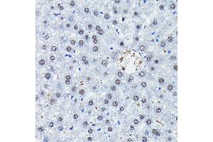 Immunohistochemistry of paraffin-embedded rat liver using C/EBPB Rabbit pAb (ABIN6134025, ABIN6138382, ABIN6138383 and ABIN6213964) at dilution of 1:100 (40x lens). (CEBPB 抗体  (AA 150-250))