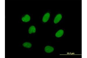 Immunofluorescence (IF) image for anti-Interleukin Enhancer Binding Factor 2, 45kDa (ILF2) (AA 1-390) antibody (ABIN517145)