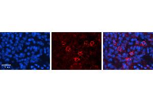 Immunohistochemistry (IHC) image for anti-C-terminal Binding Protein 1 (CTBP1) (C-Term) antibody (ABIN2779661)