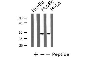 Western blot analysis of extracts from HuvEc/HeLa cells, using LHX1 antibody. (LHX1 抗体  (Internal Region))
