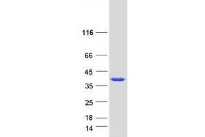 Western Blotting (WB) image for Axin Interactor, Dorsalization Associated (AIDA) protein (Myc-DYKDDDDK Tag) (ABIN2714478)