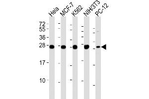 Lane 1: HeLa Cell lysates, Lane 2: MCF-7 Cell lysates, Lane 3: K562 Cell lysates, Lane 4: NIH/3T3 Cell lysates, Lane 5: PC-12 Cell lysates, probed with IF4E (1504CT774. (EIF4E2 抗体)