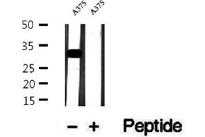 Western blot analysis of extracts of A375 cells, using Histone H1. (HIST1H1C 抗体  (N-Term))